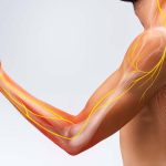 Kendala Penyakit Saraf Kejepit Yang Di Alami Seseorang