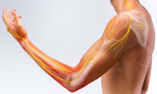 Kendala Penyakit Saraf Kejepit Yang Di Alami Seseorang