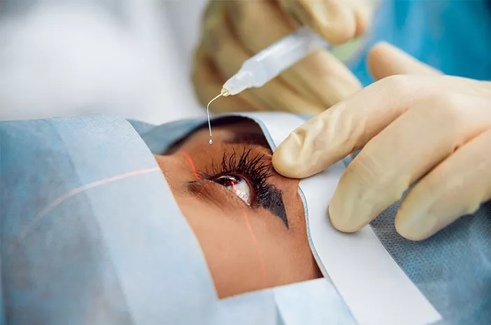 Prosedur Pembedahan Mata Dengan Melakukan Tindakan Lasik